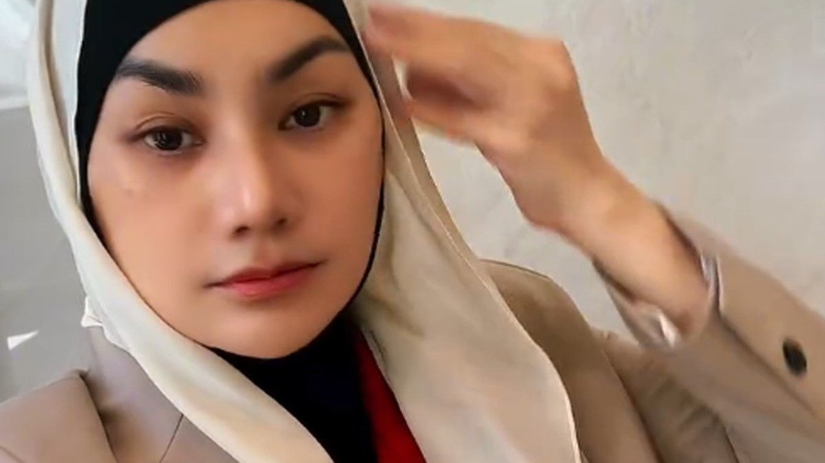 Sarita Abdul Mukti Jalani Operasi Wajah dan Hidung di Thailand